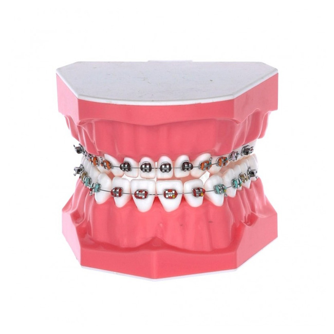 Brackets en queretaro